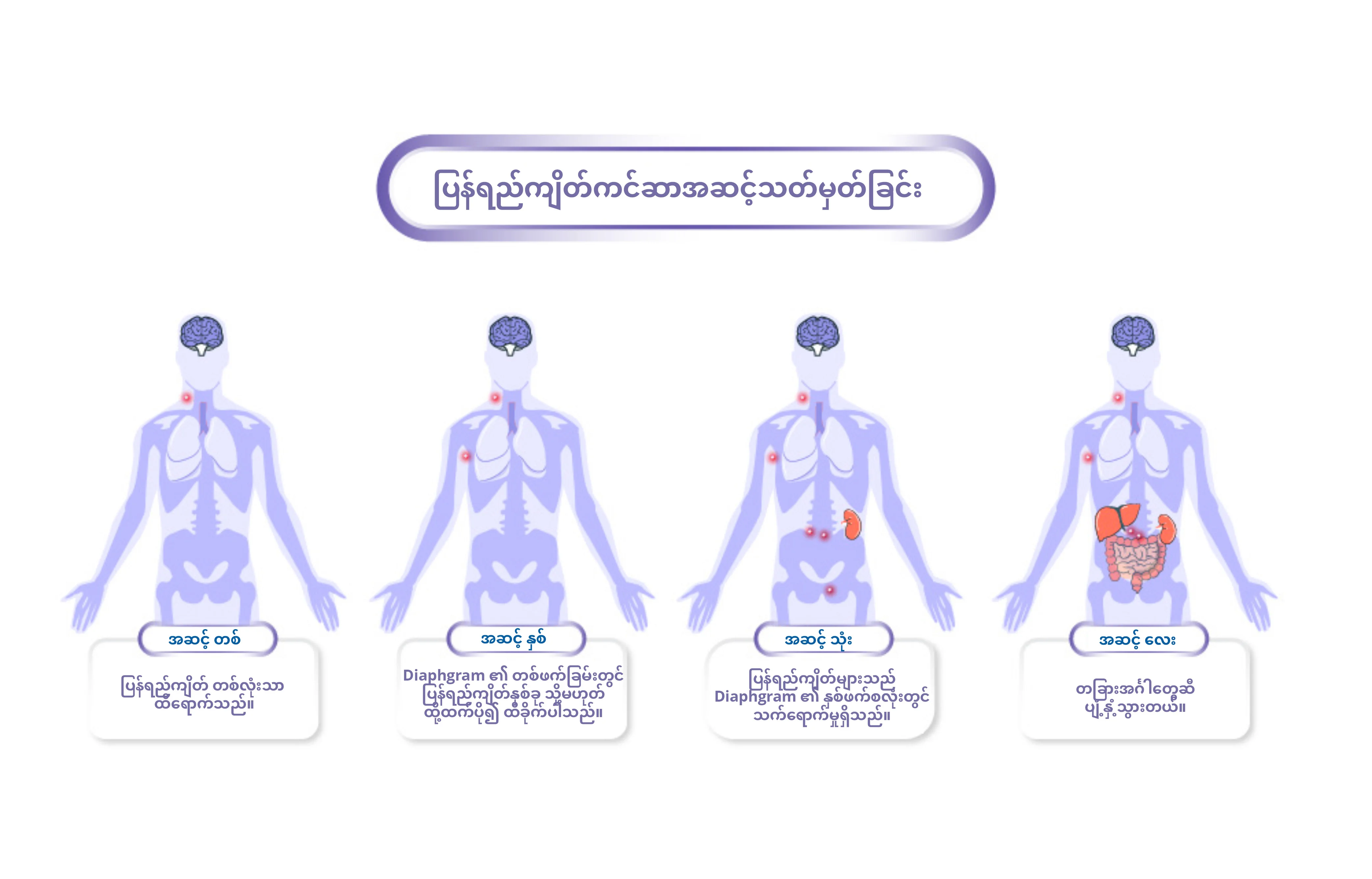 Lymphoma ၏အဆင့်