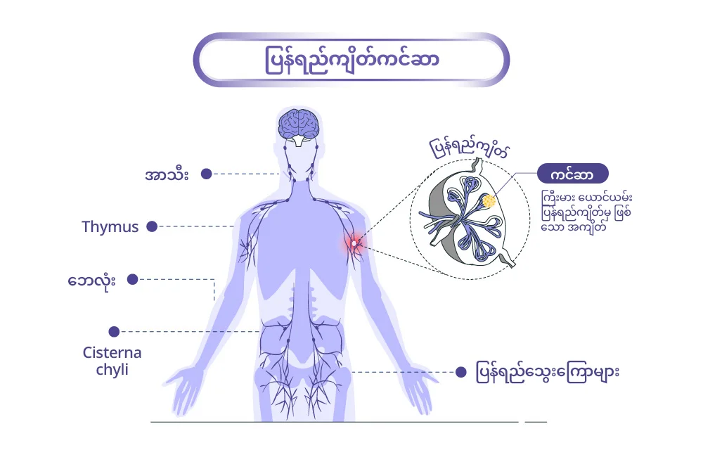 lymph node ကင်ဆာ ခန္ဓာဗေဒ