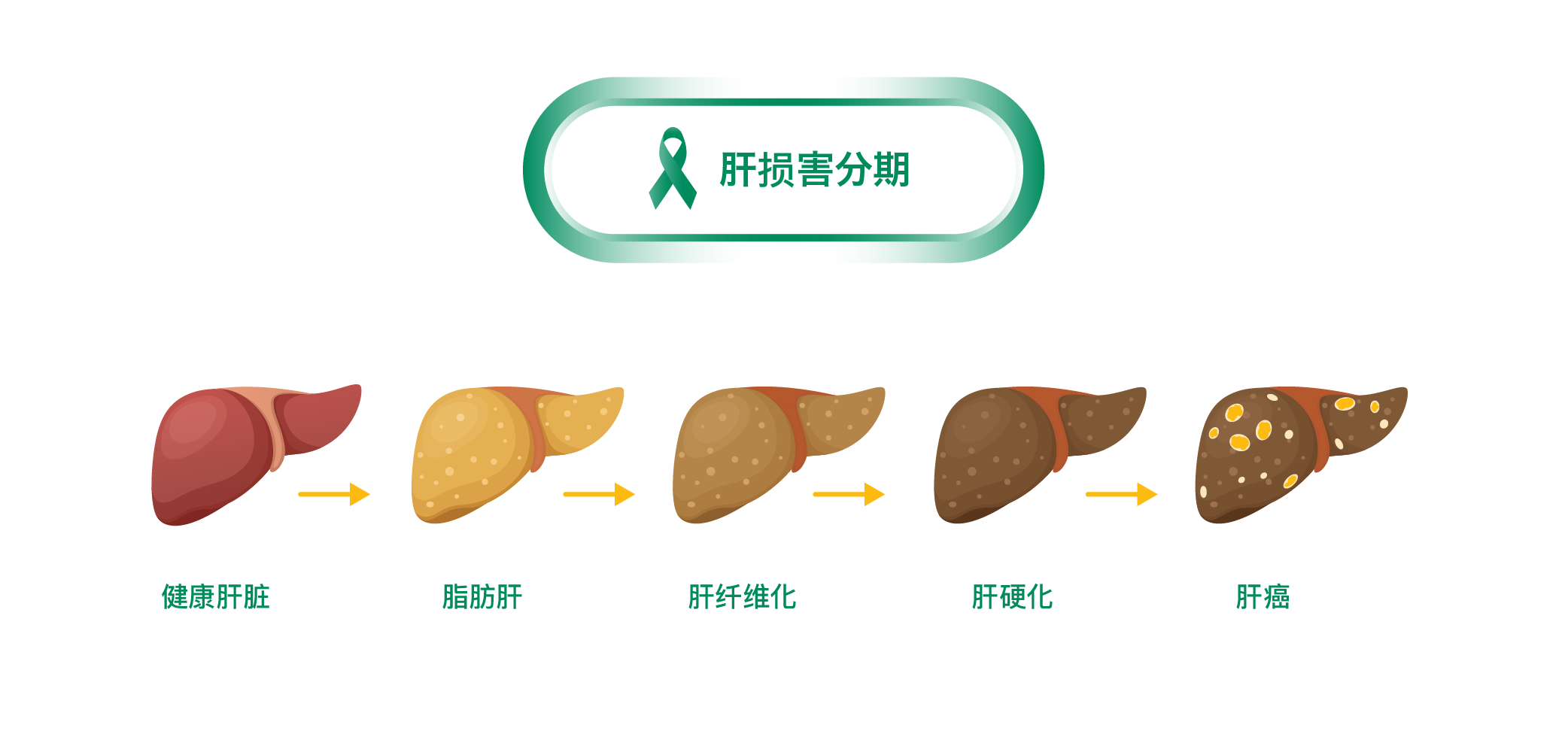 Stages of Liver Damage