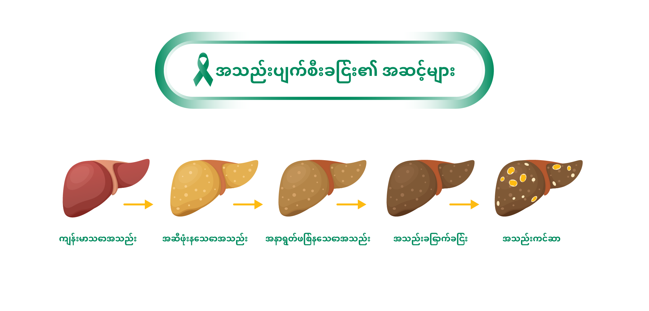 Stages of Liver Damage