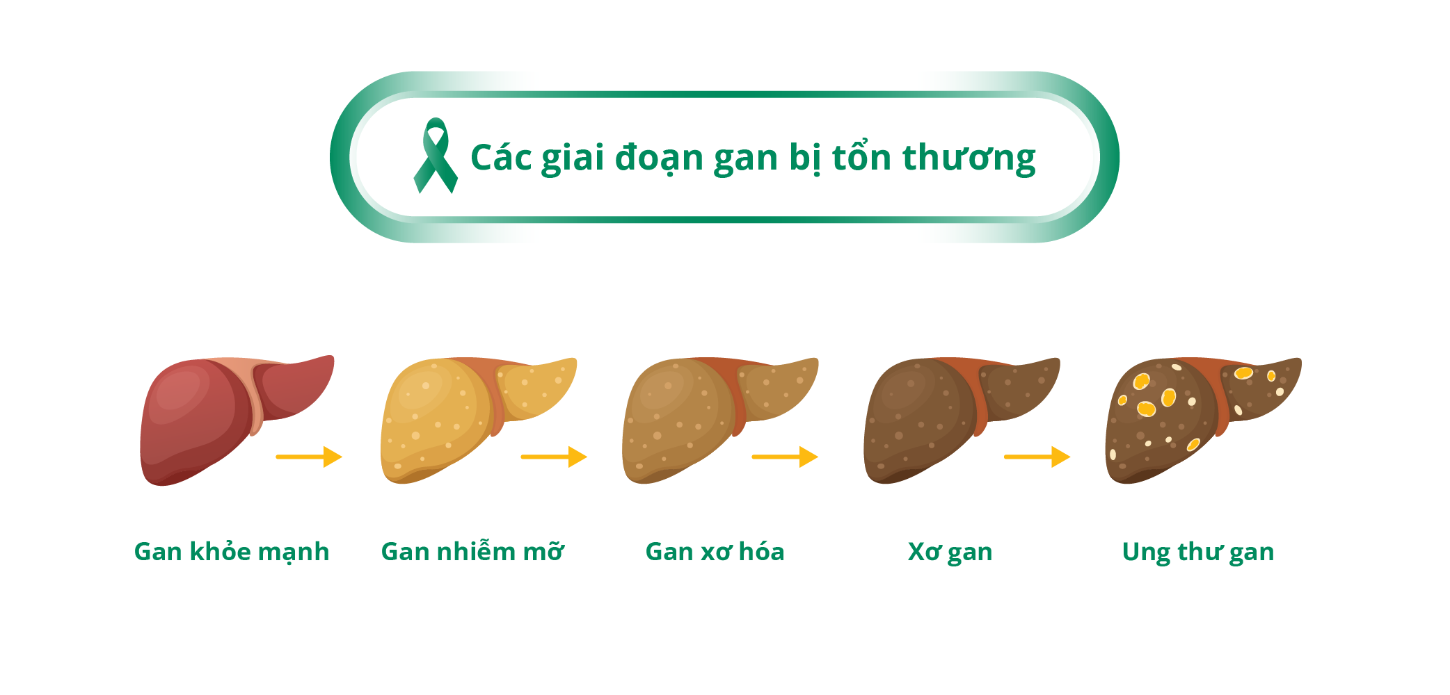 Stages of Liver Damage